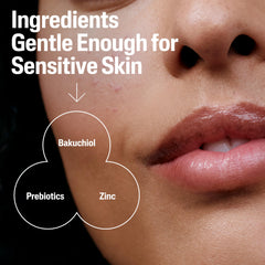 Zinc and Prebiotics formula highlights barrier support and oil control