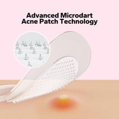 CharmCherry hydrocolloid patch covers blemish discreetly for daytime wear under makeup.
