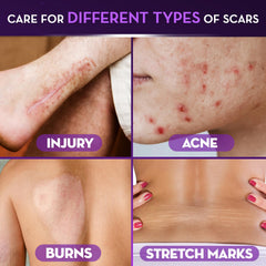 Cicatricure Advanced Scar Gel on a surgical scar, before and after reference.