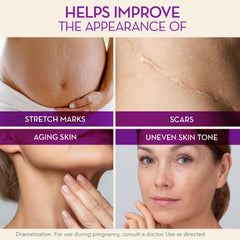 Pregnancy belly care with Cicatricure Cica Oil.