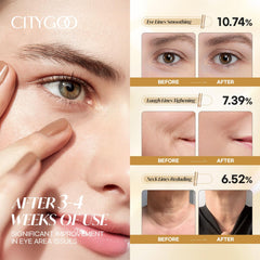 CITYGOO Retinol Eye Stick packaging demonstrates travel-friendly design.