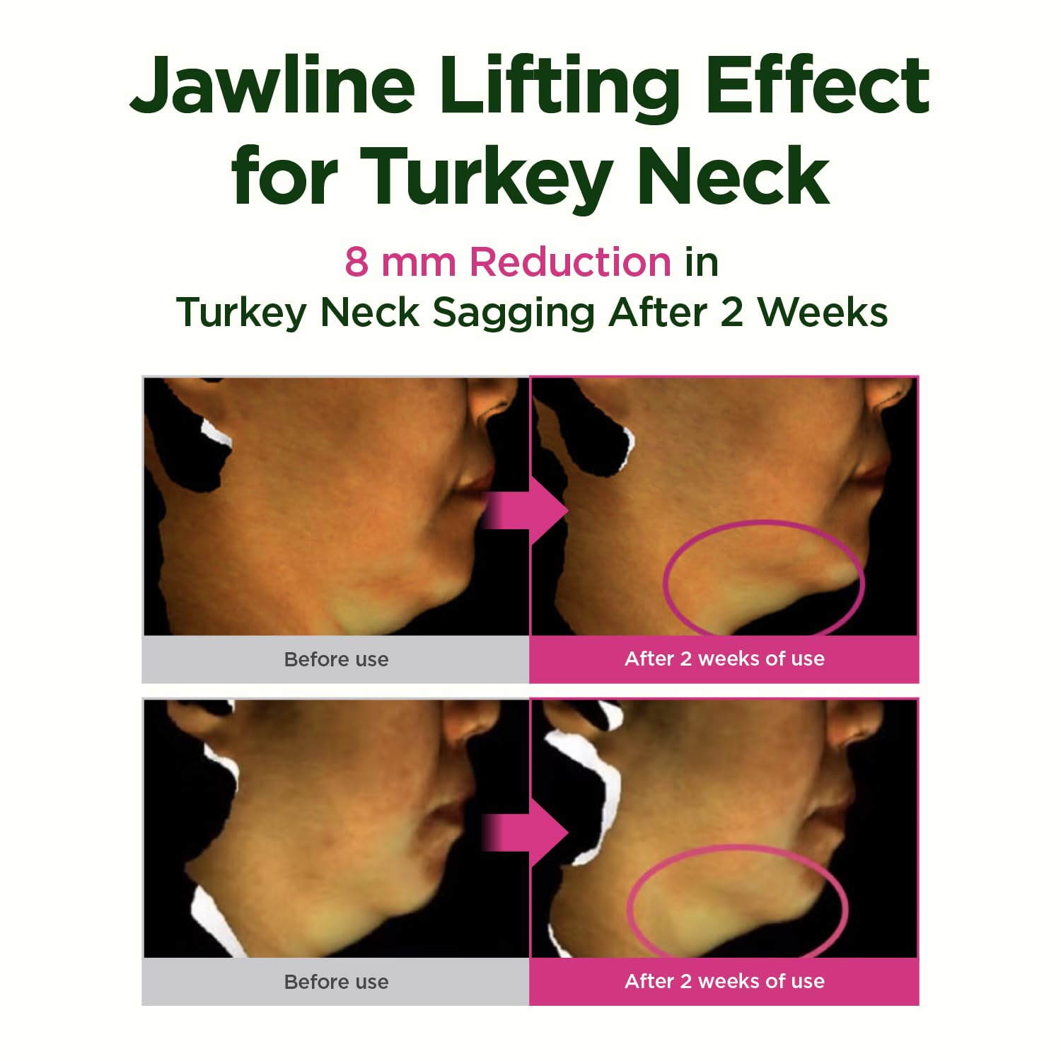 CKD Guasha neck cream applied near jawline for lifted appearance.