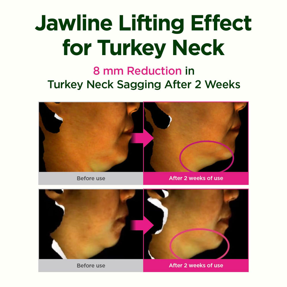 CKD Guasha neck cream applied near jawline for lifted appearance.