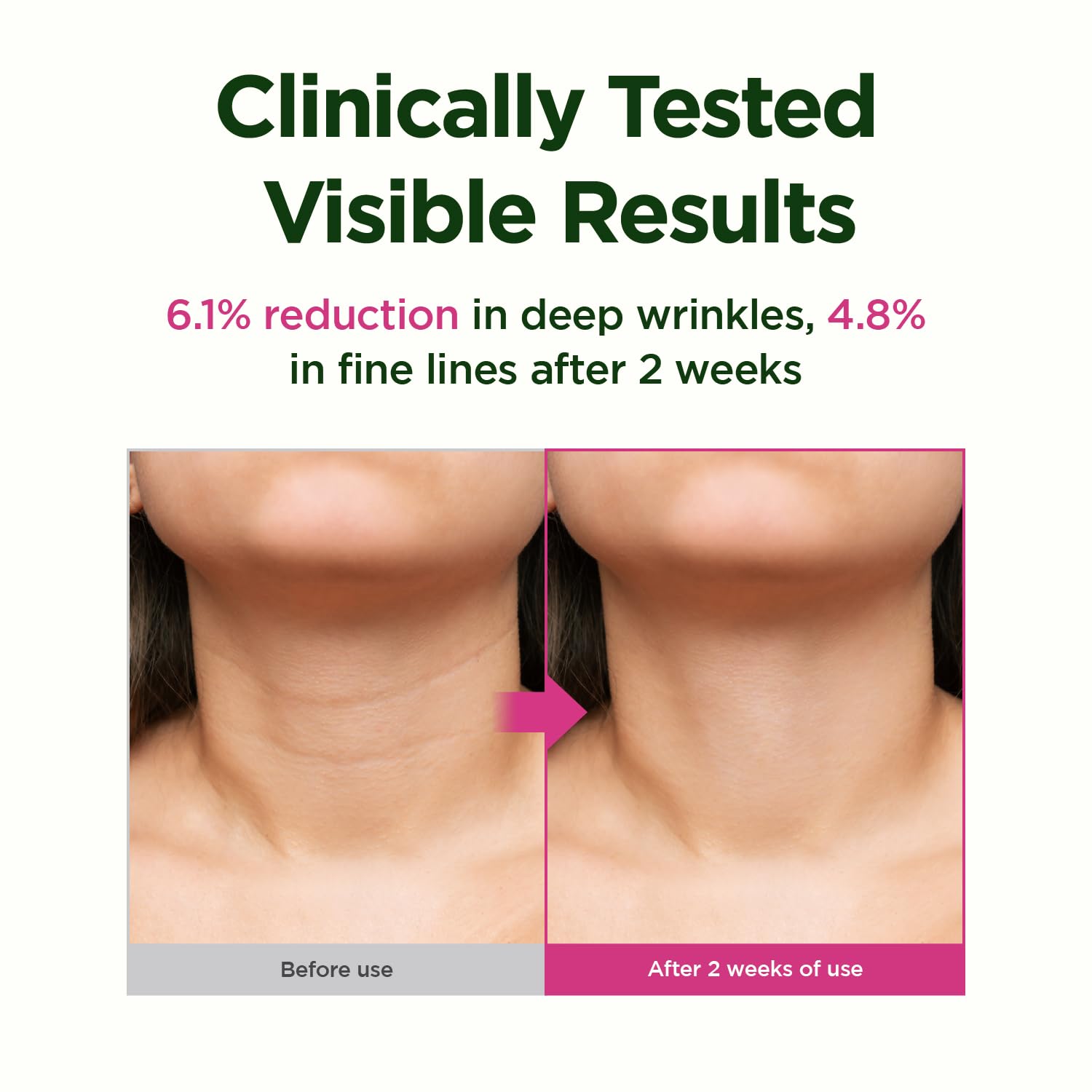 CKD Retinol and collagen combo supports smoother texture and reduced visibility of lines.