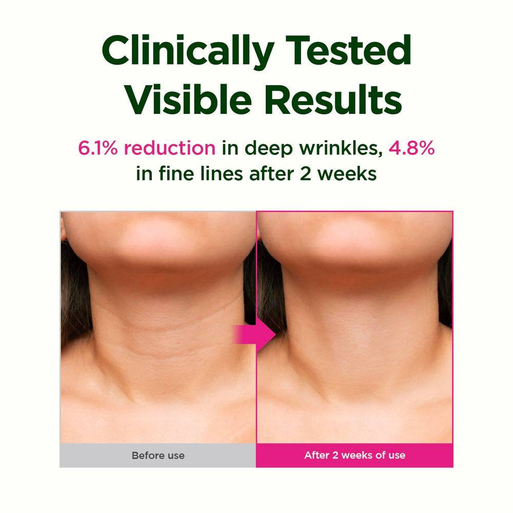 CKD Retinol and collagen combo supports smoother texture and reduced visibility of lines.
