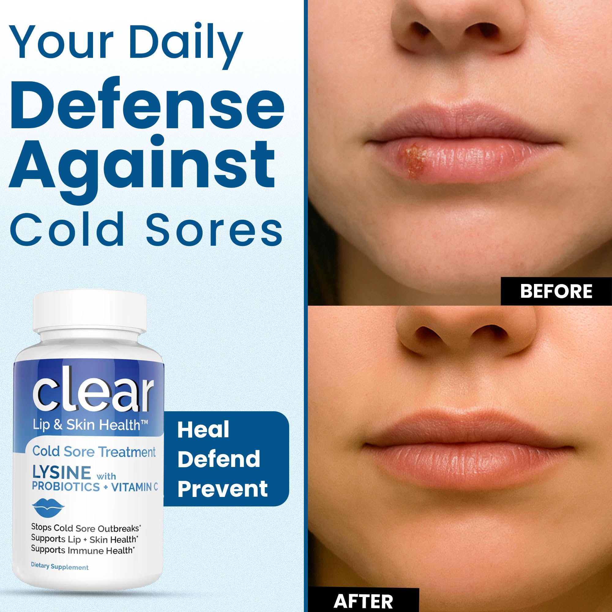 Capsules texture from Clear Probiotics Lysine Capsules demonstrates gentle digestion.