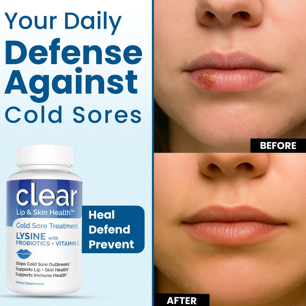 Capsules texture from Clear Probiotics Lysine Capsules demonstrates gentle digestion.