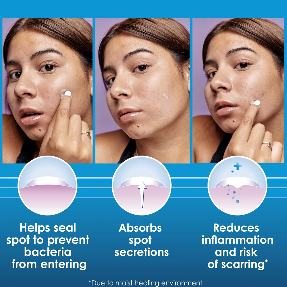 Clearasil Spot Patches applied to a pimple with gentle coverage.