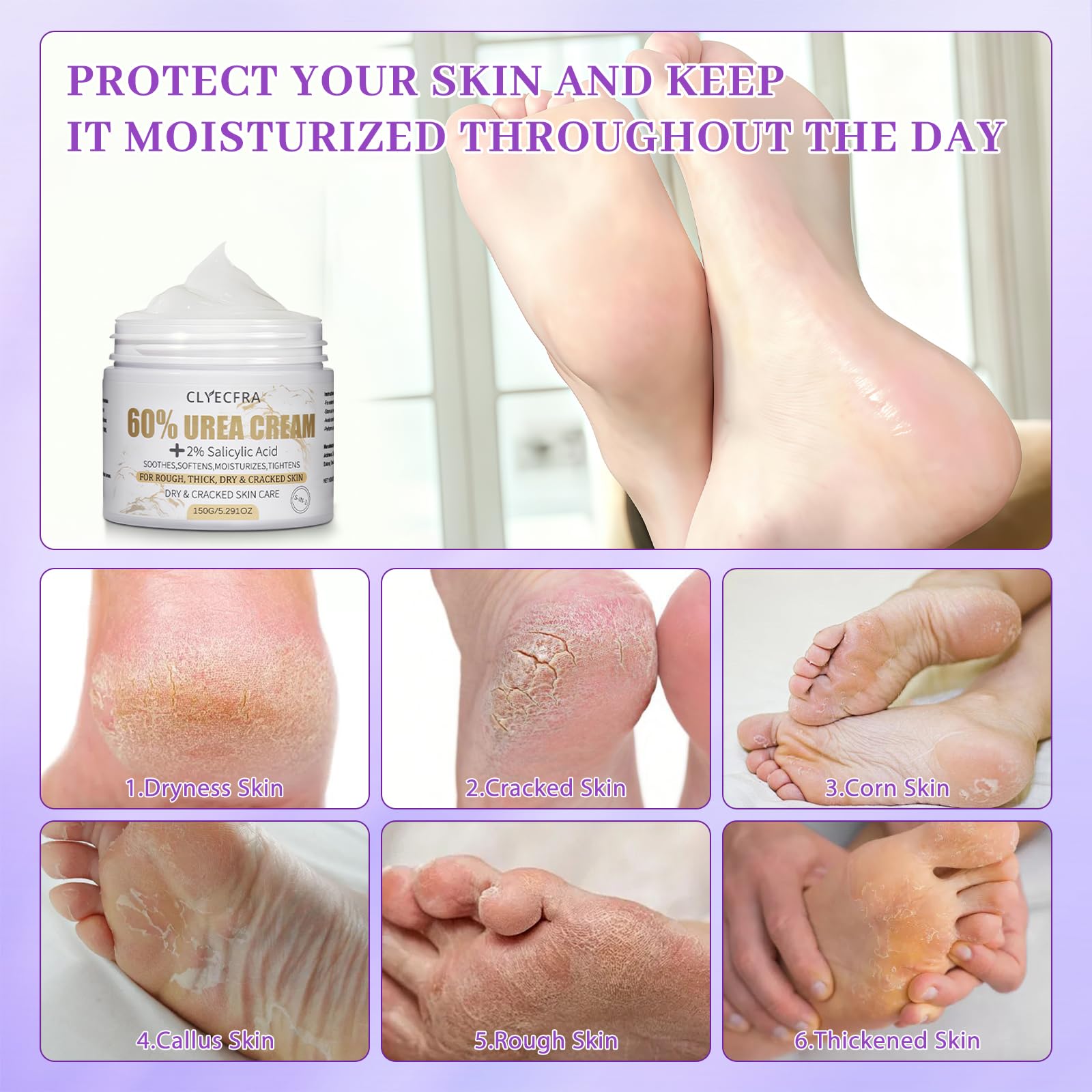 Applying Clyecfra cream on heels to soothe rough skin.