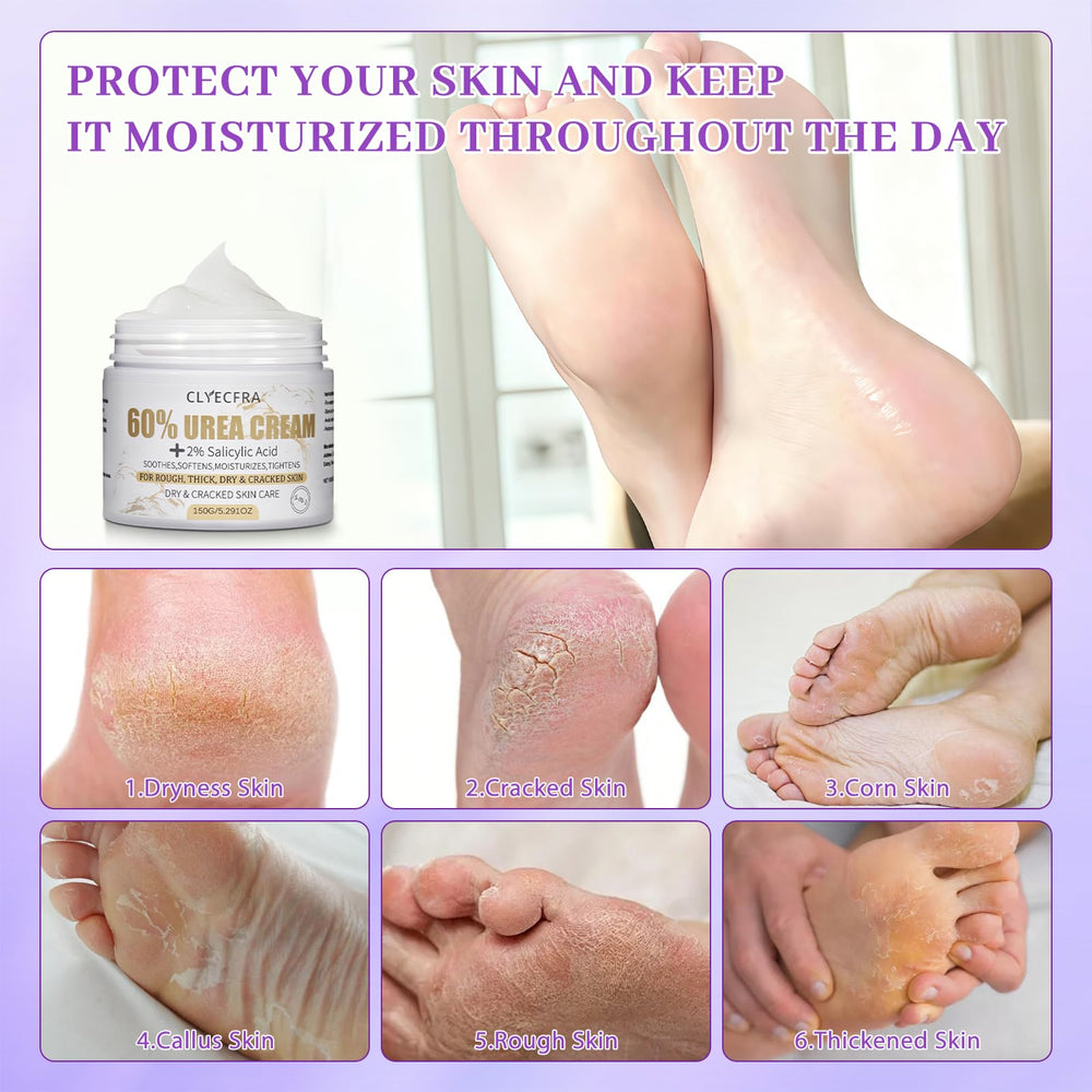 Applying Clyecfra cream on heels to soothe rough skin.