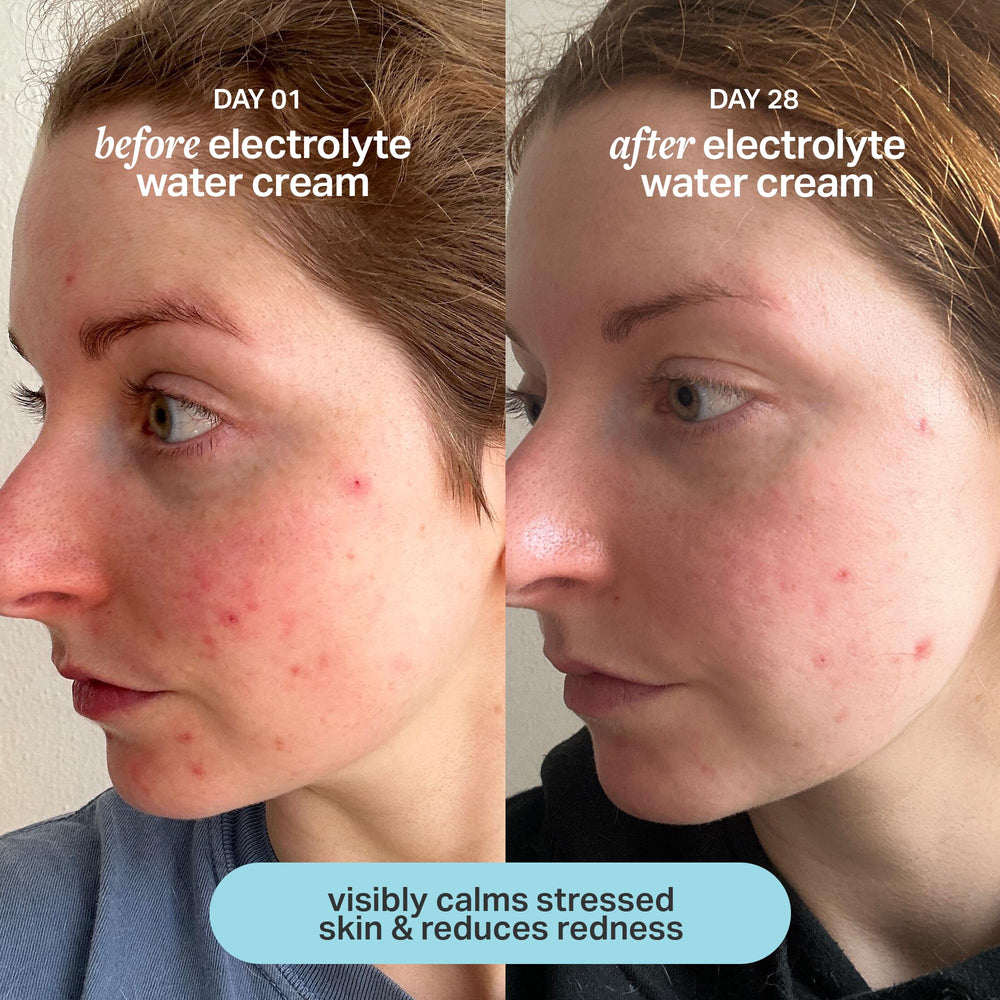 Cocokind Electrolyte Water Cream massaged onto the face for lightweight hydration.