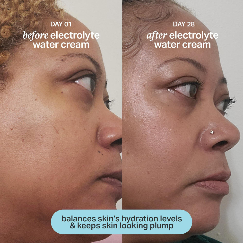 Cocokind Electrolyte Water Cream on neck showing smooth, calm skin.