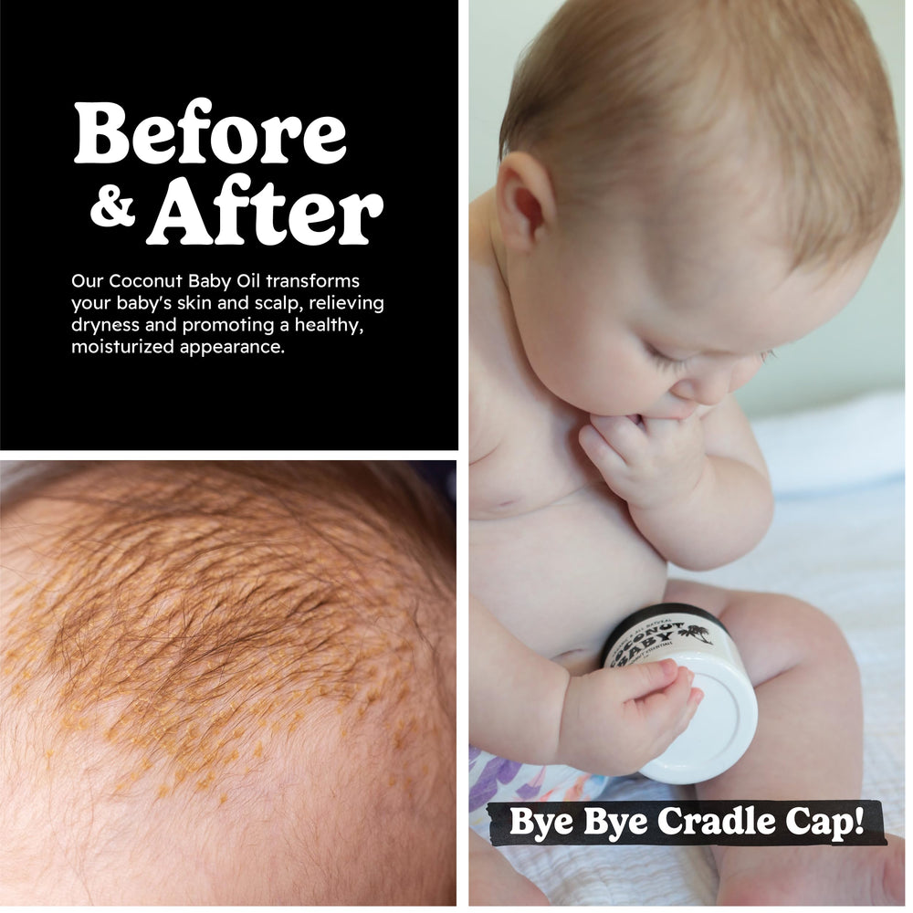 Coconut Essentials Baby Oil fragrance-free formula for extra-sensitive skin