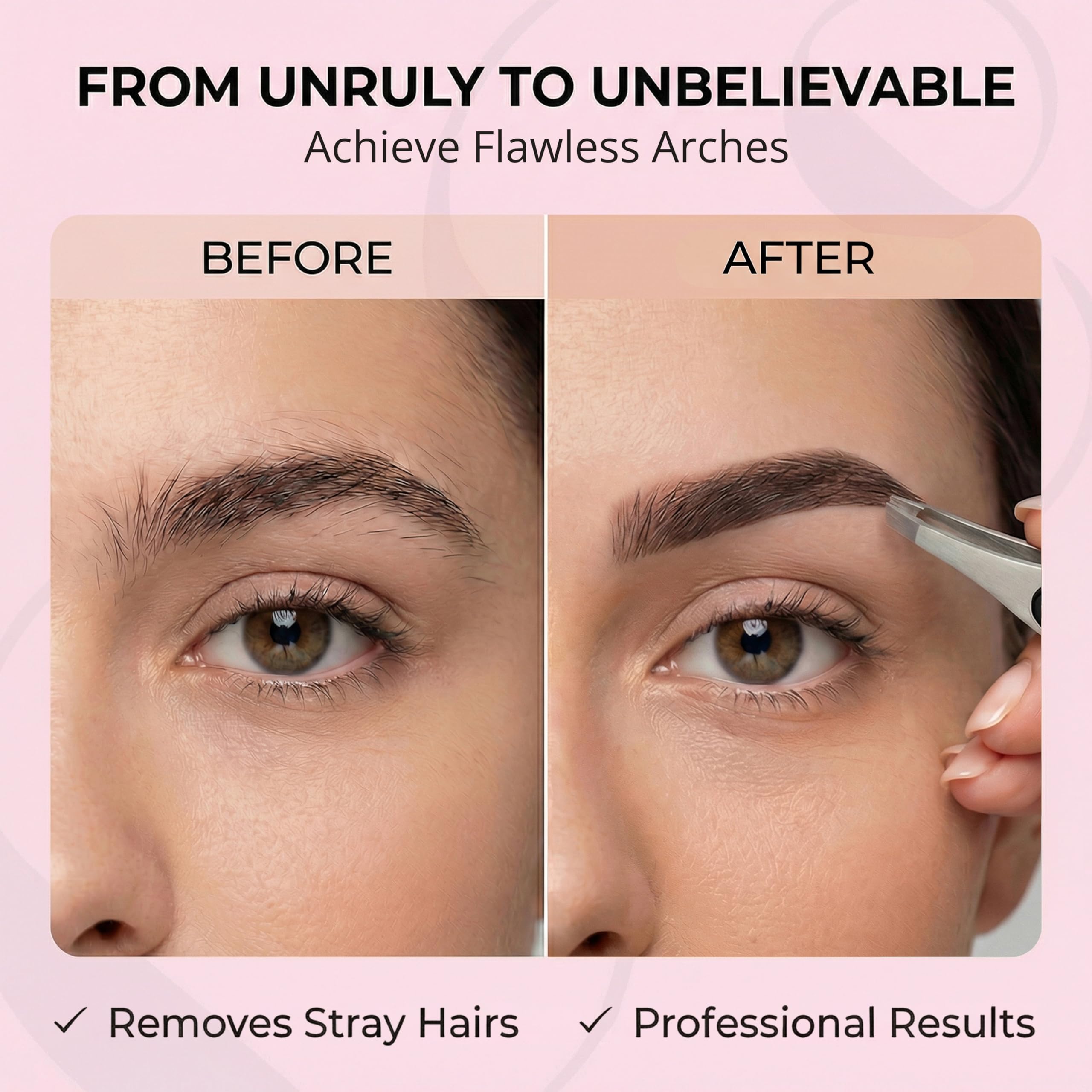 Coco's Closet ingrown hair removal tool with minimal tugging.