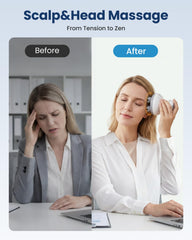 COMFIER four-head scalp massager with rotating kneading nodes
