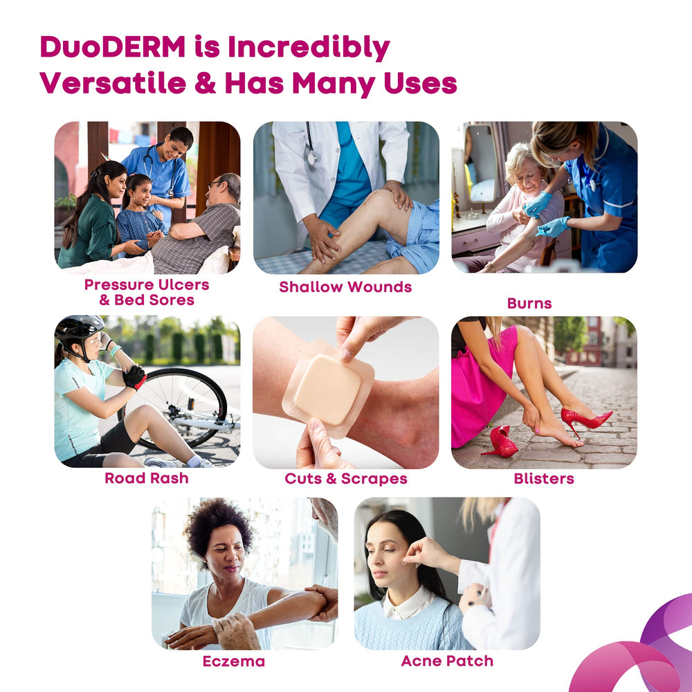Adhesive layer of DuoDERM Control gel dressing adheres gently.