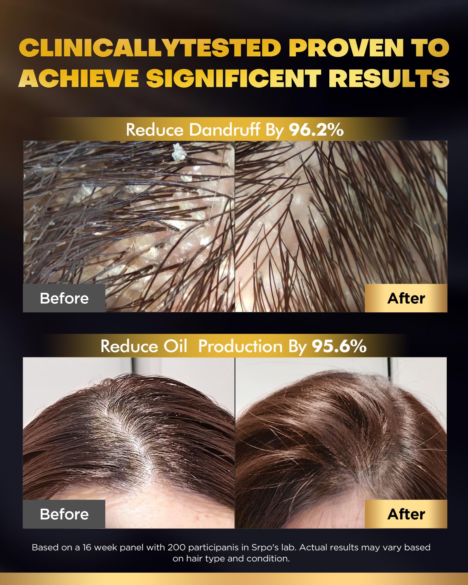 COOLKESI Dandruff-Fighting Foam bottle offering deep-cleaning and oil-control.