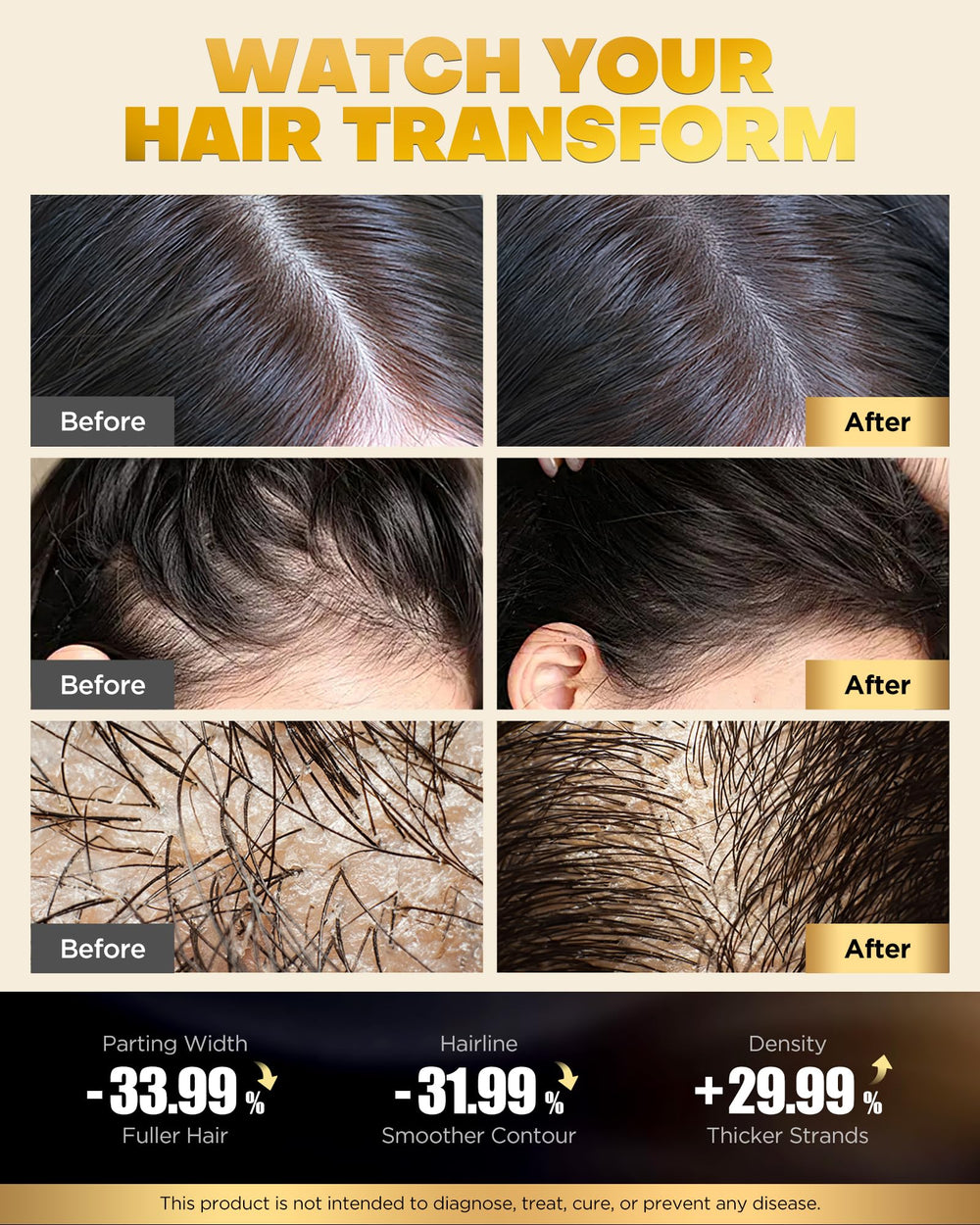 COOLKESI Onion-Extract Scalp Clarifying Shampoo bottle highlighting balanced scalp.