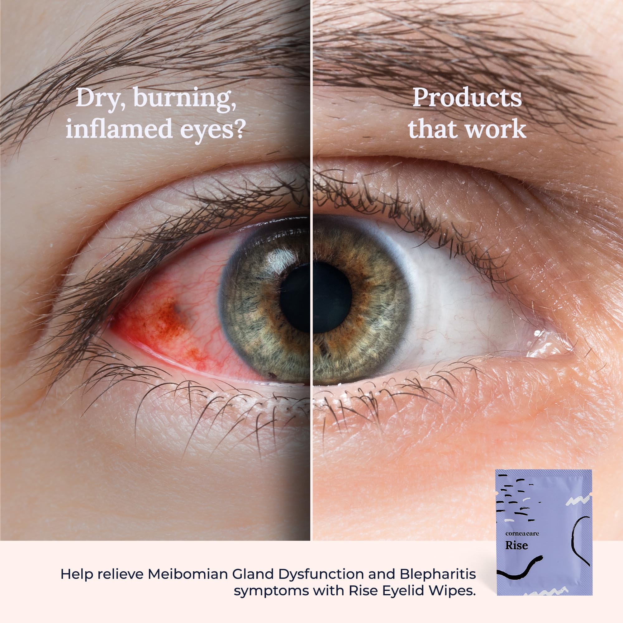 CorneaCare Rise supports gentle skin care around the eye area