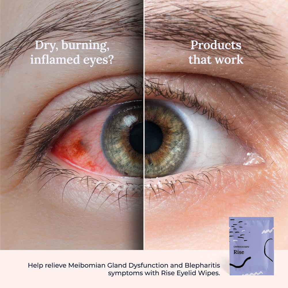 CorneaCare Rise supports gentle skin care around the eye area