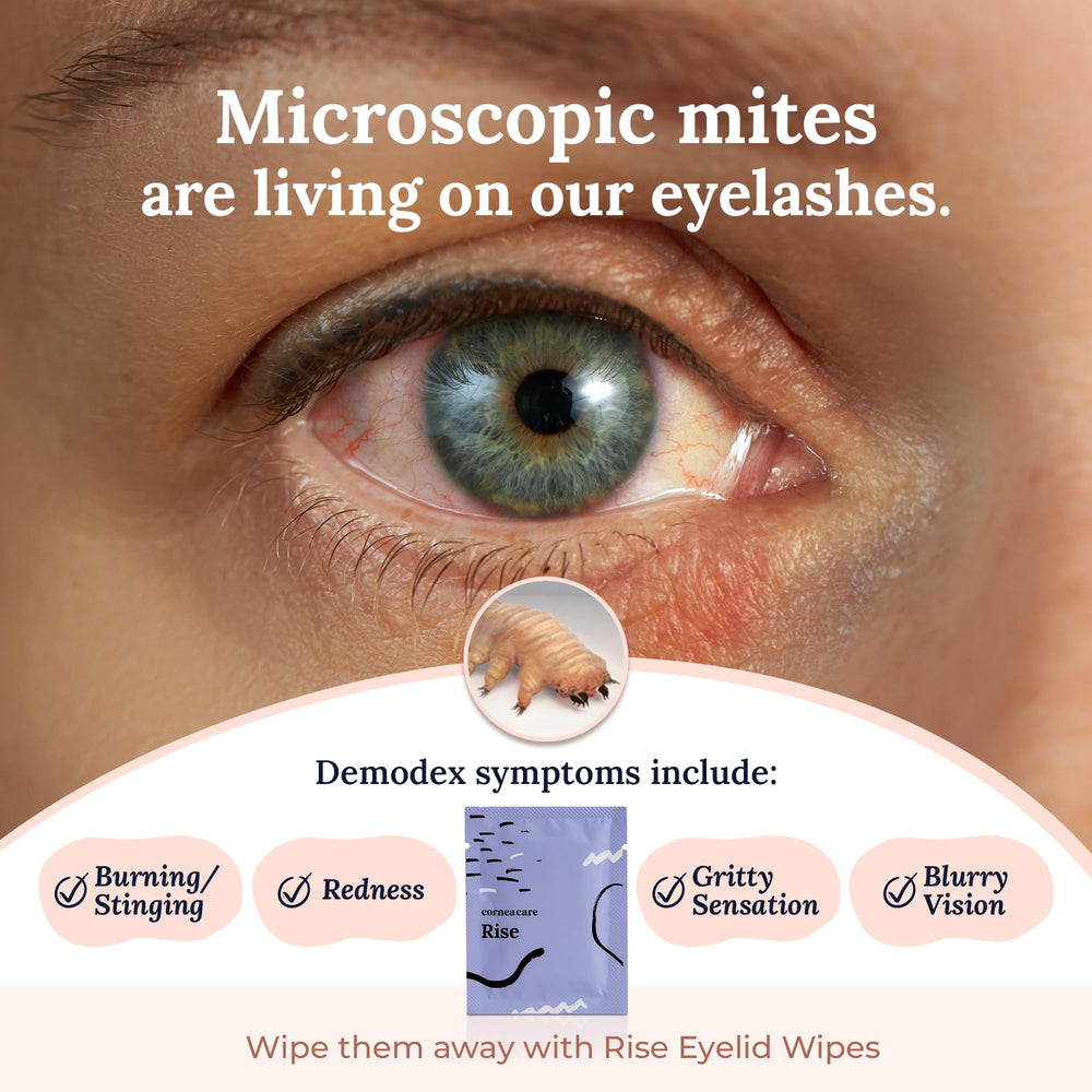 CorneaCare Rise wipes with hyaluronic acid provide hydration for lids