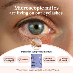 CorneaCare Rise wipes with hyaluronic acid provide hydration for lids