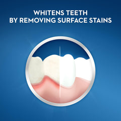 Close-up of Crest Pro-Health Gum Detoxify Plus foam on teeth during brushing
