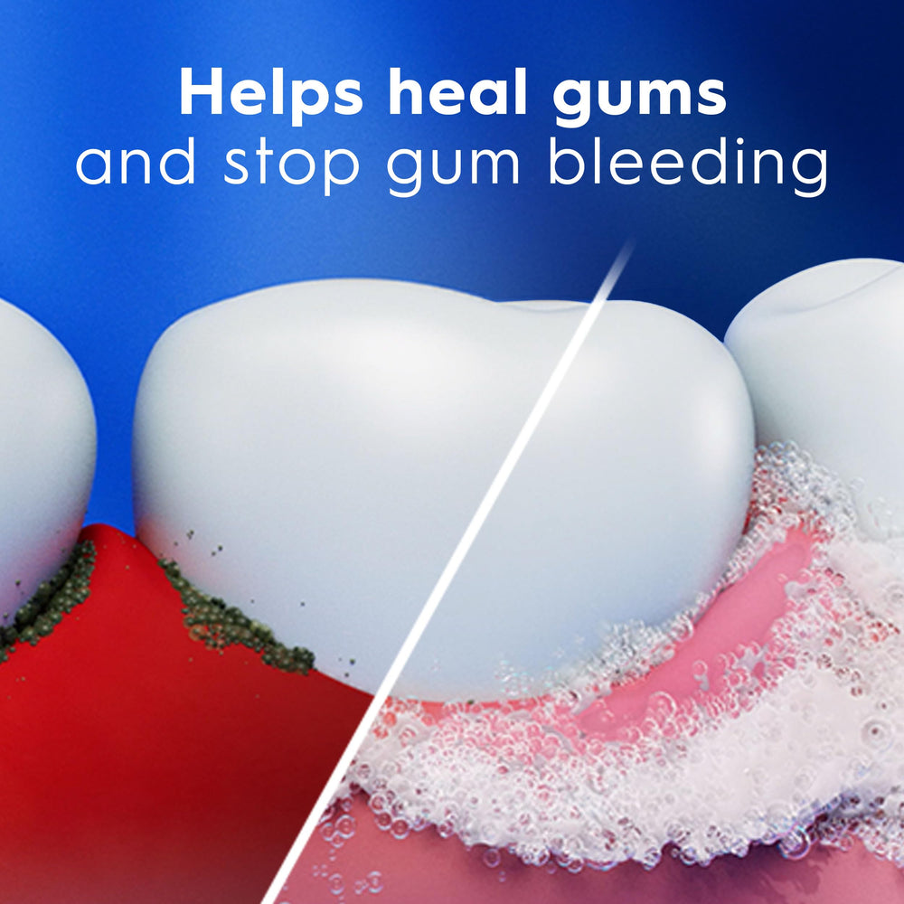 Crest Pro-Health Gum Detoxify Plus tube beside a smiling mouth suggesting gum health support