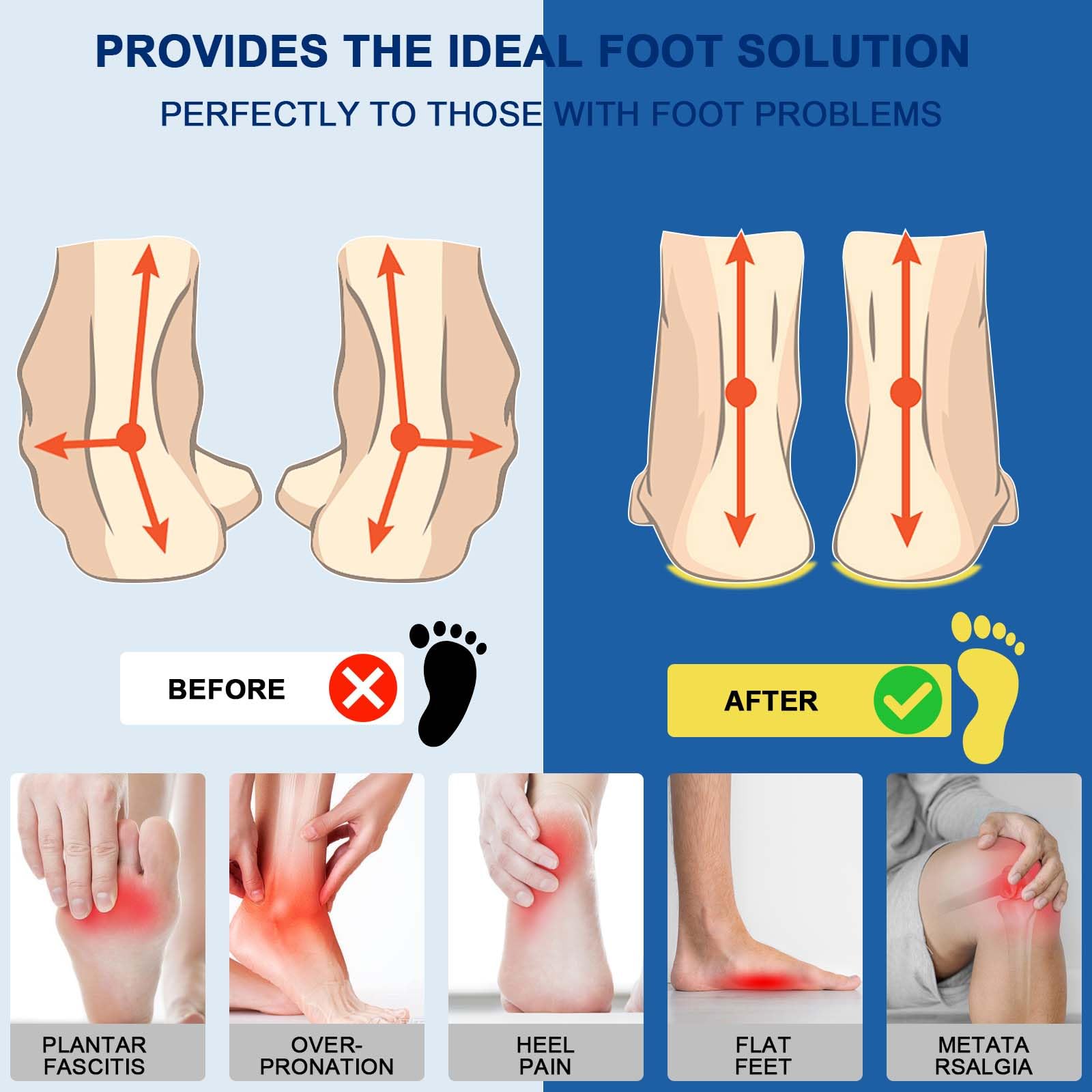 Crinova forefoot gel cushioning in action on steps