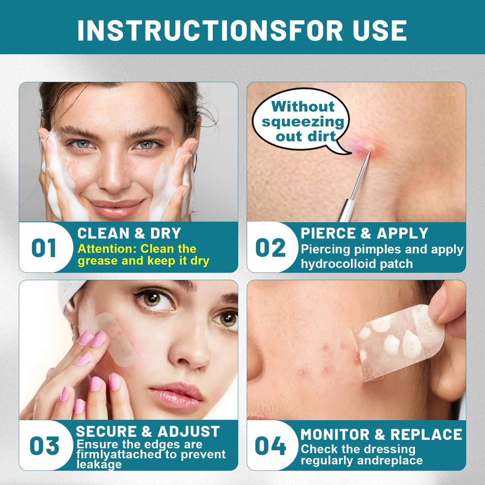CUKWUYBY acne patches effective for back acne and hard-to-reach areas.