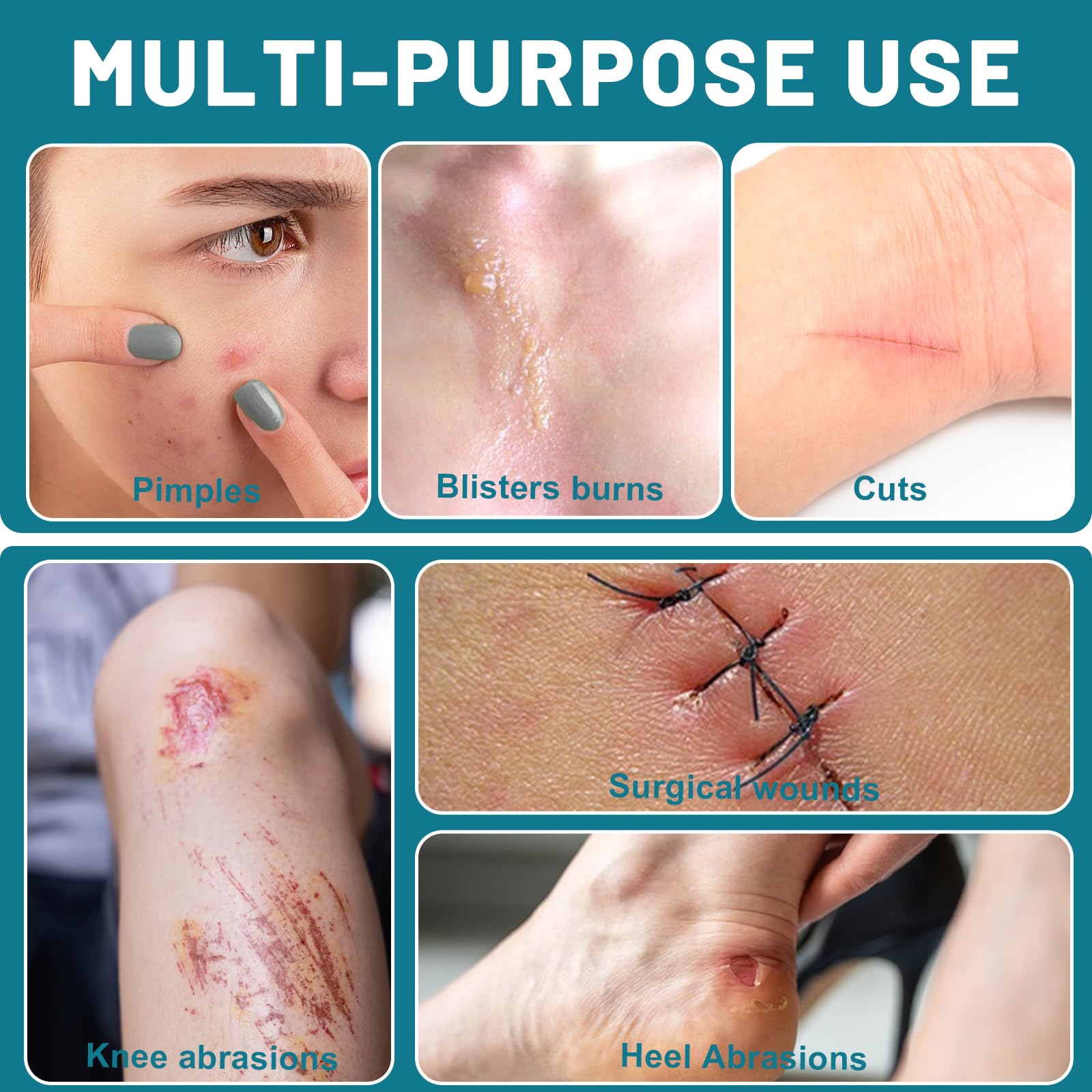 CUKWUYBY waterproof hydrocolloid bandage protects wound during water exposure