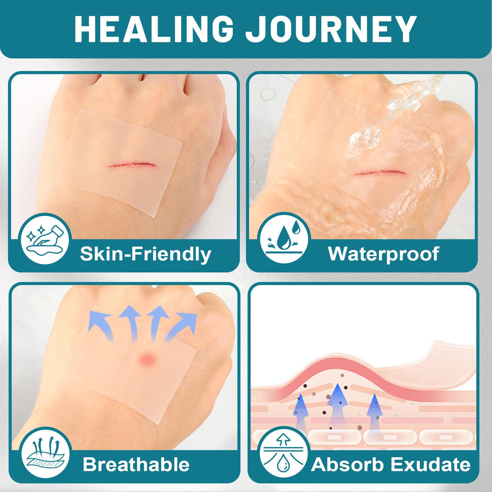 CUKWUYBY waterproof hydrocolloid dressings stay in place during showers or swims.