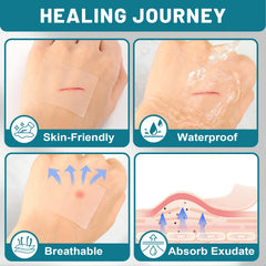 CUKWUYBY waterproof hydrocolloid dressings stay in place during showers or swims.