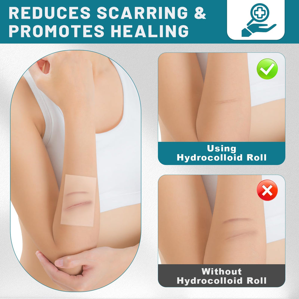 CUKWUYBY versatile hydrocolloid patch for facial, joints, and minor injuries.