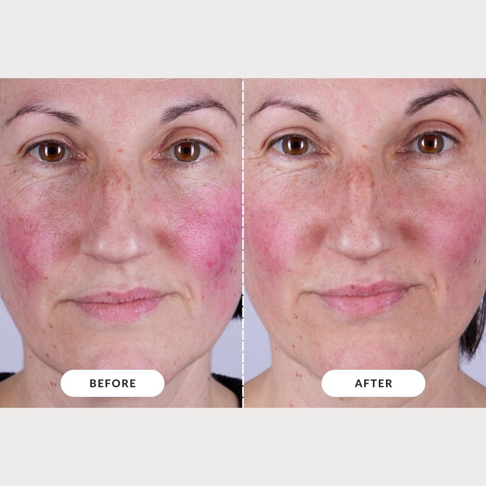 CurrentBody Skin LED Series 2 glow effect preview for a brighter look
