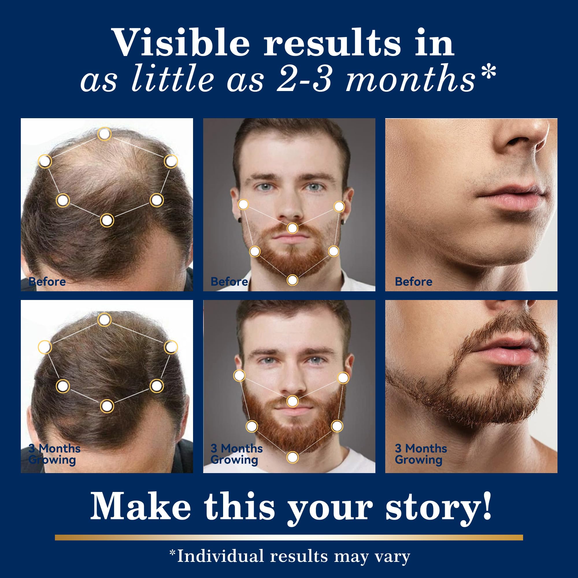 DAAZZS biotin-enriched minoxidil formula to nourish the scalp.