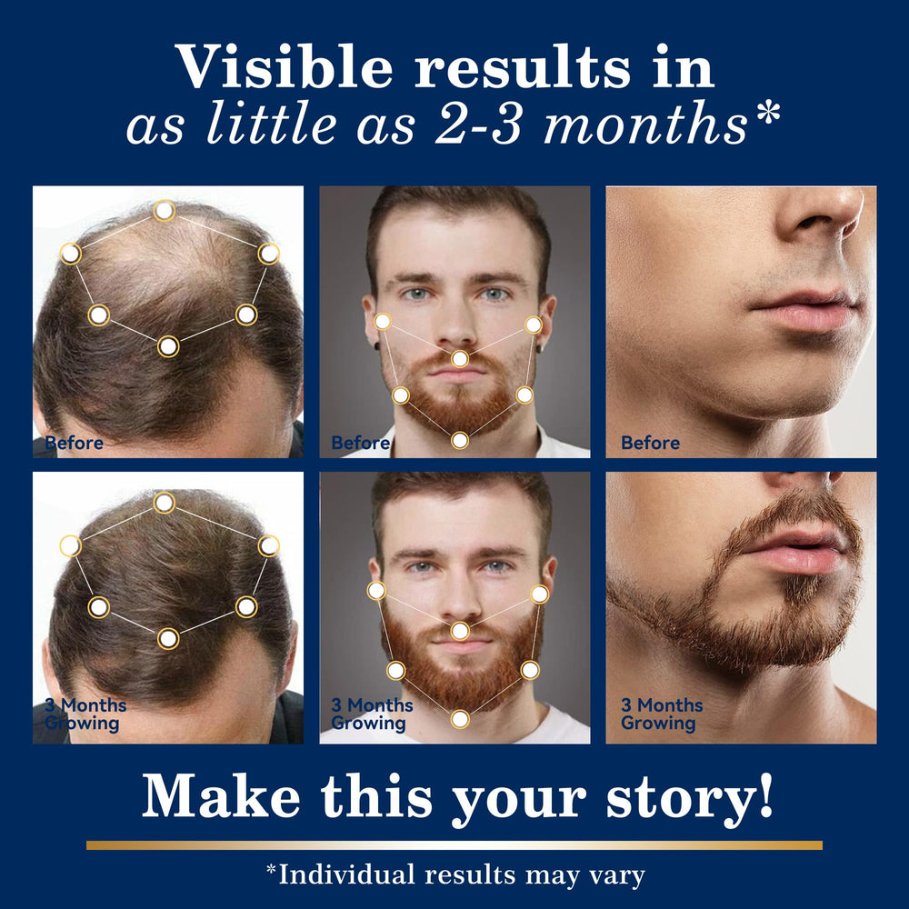 DAAZZS biotin-enriched minoxidil formula to nourish the scalp.