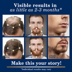 DAAZZS biotin-enriched minoxidil formula to nourish the scalp.
