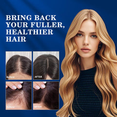 DAAZZS fragrance-free minoxidil solution ideal for sensitive scalps.