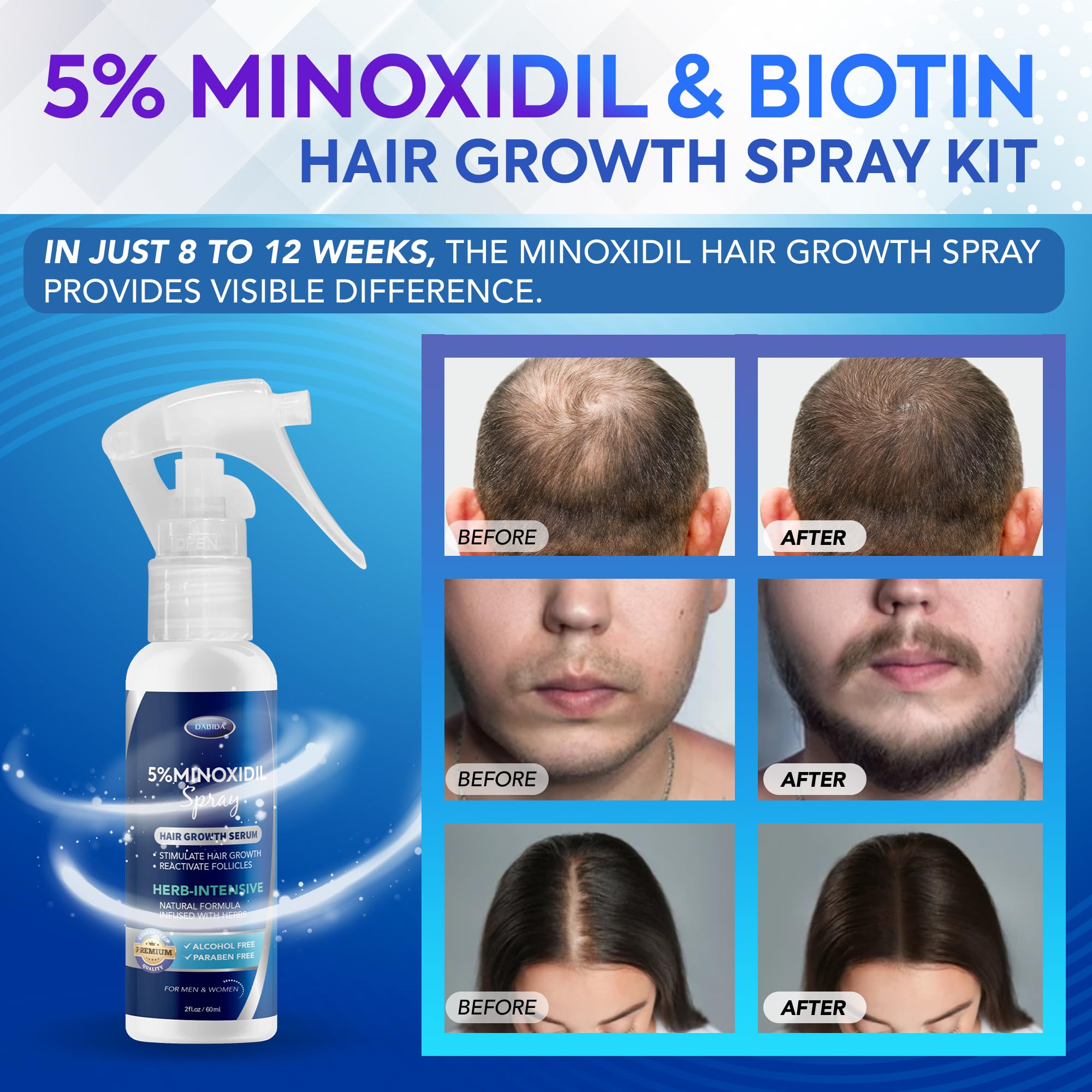 DABIDA Minoxidil spray-dispense ensures even coverage for scalp areas.