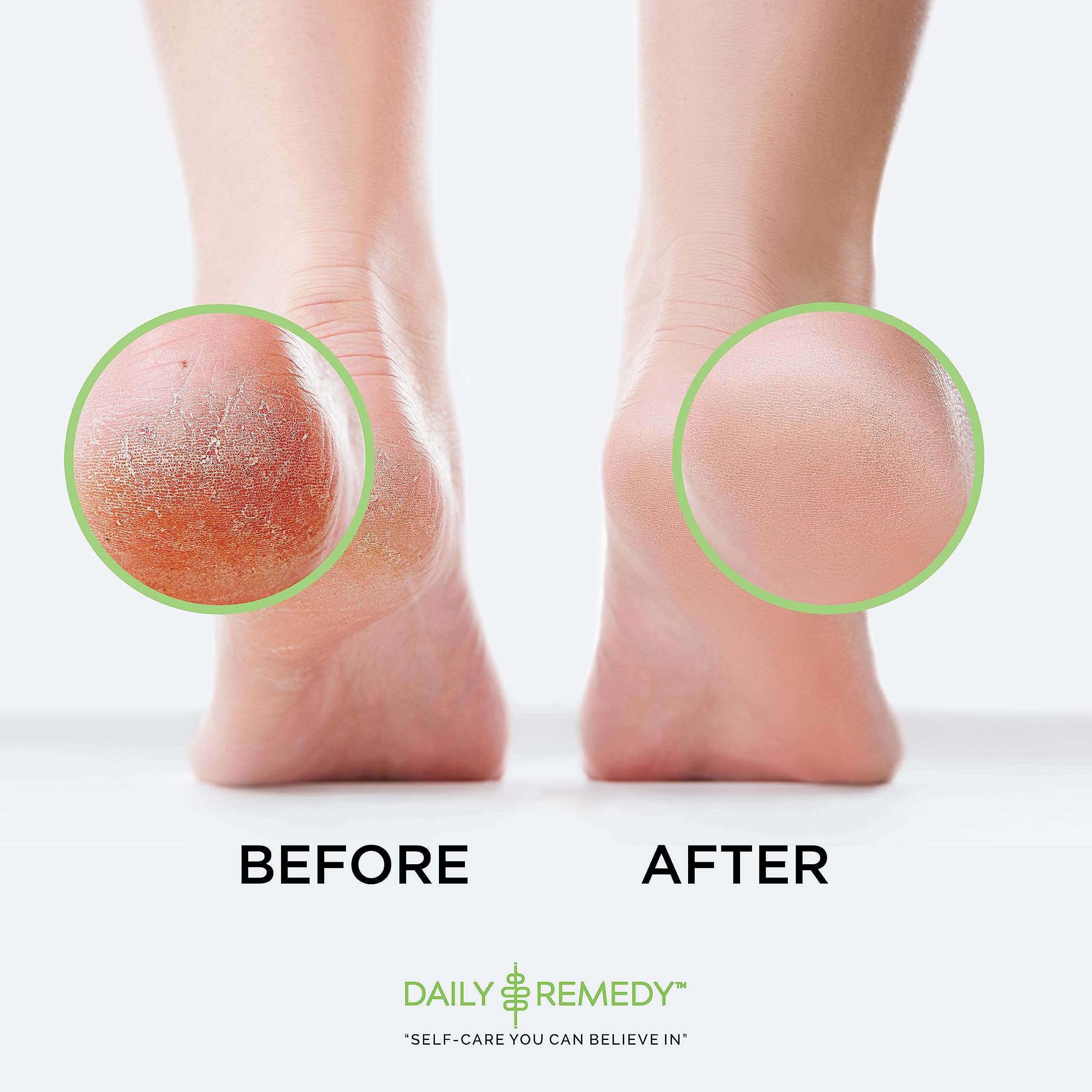 Daily Remedy pedicure setup scene suggests easy at-home spa ritual