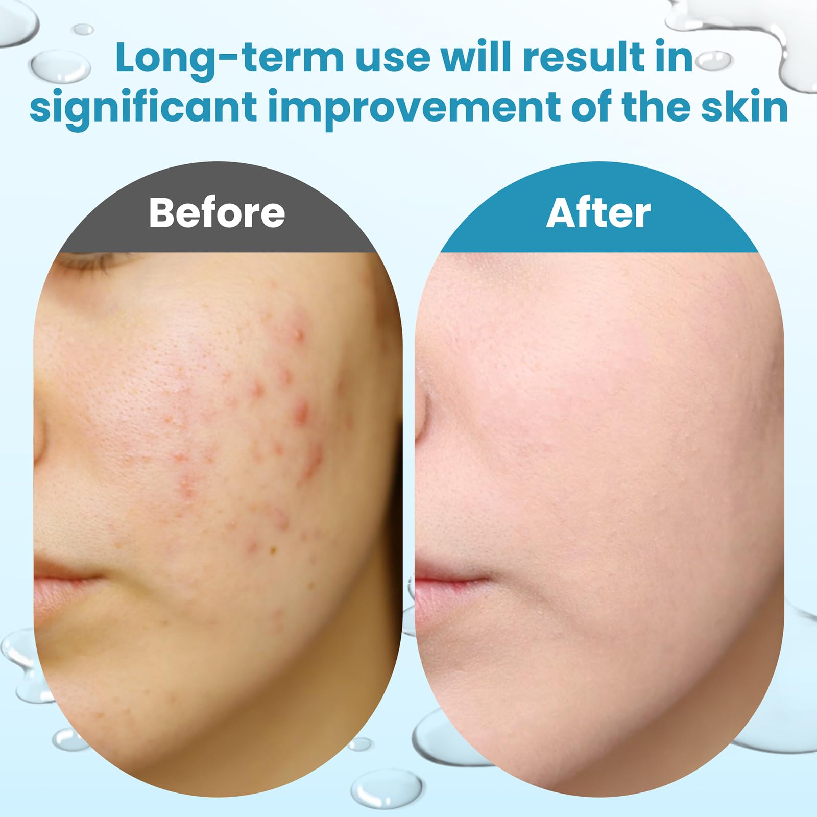 Dalin Glycolic Pad application swiping across skin for gentle use.