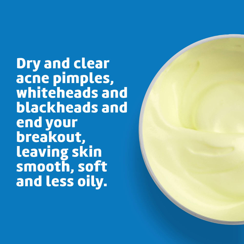 Thin layer of De La Cruz Sulfur Ointment on the face during a 10-minute treatment.