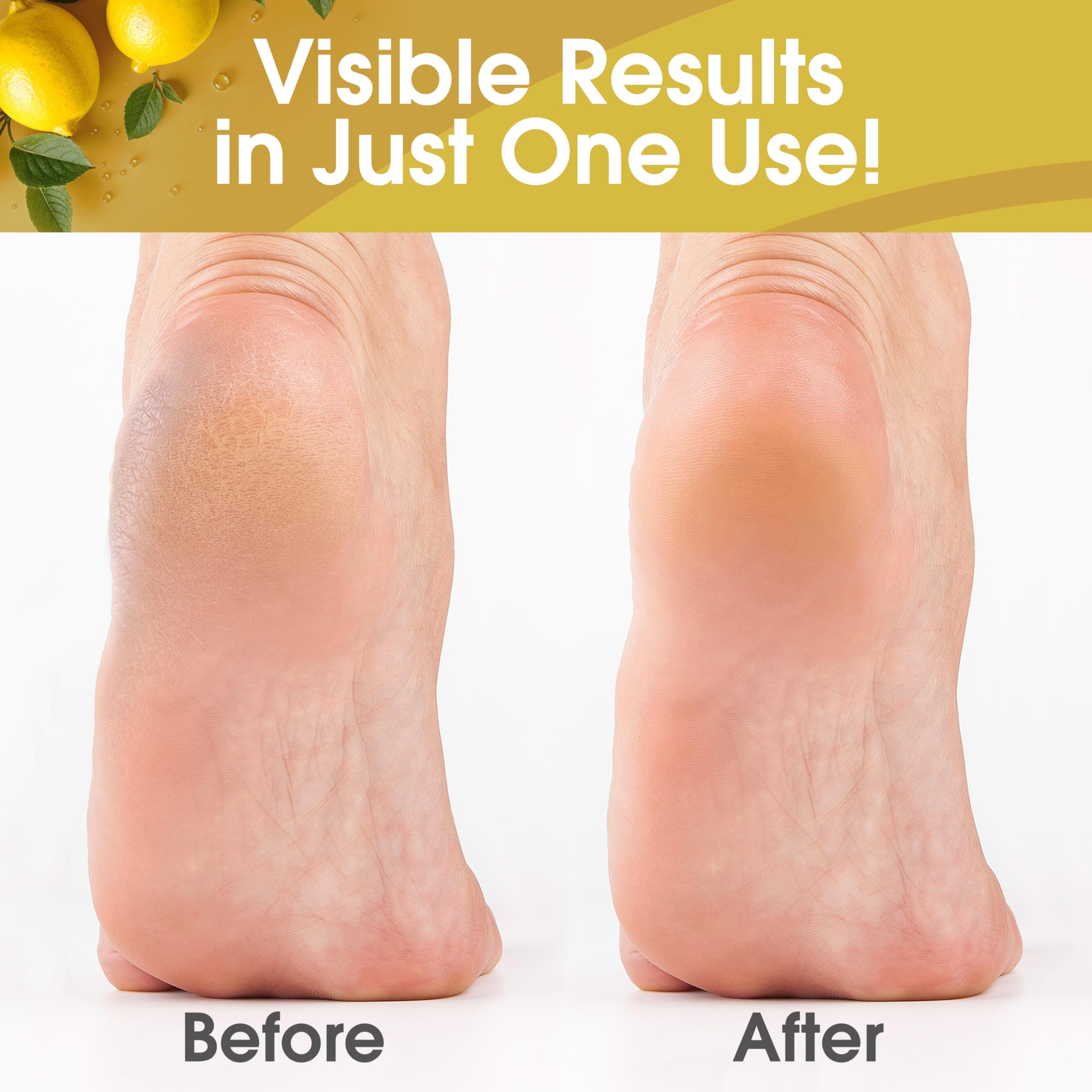 DeEnti Callus Remover front-label displays 8oz bottle and refreshing lemon scent.