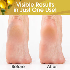 DeEnti Callus Remover front-label displays 8oz bottle and refreshing lemon scent.