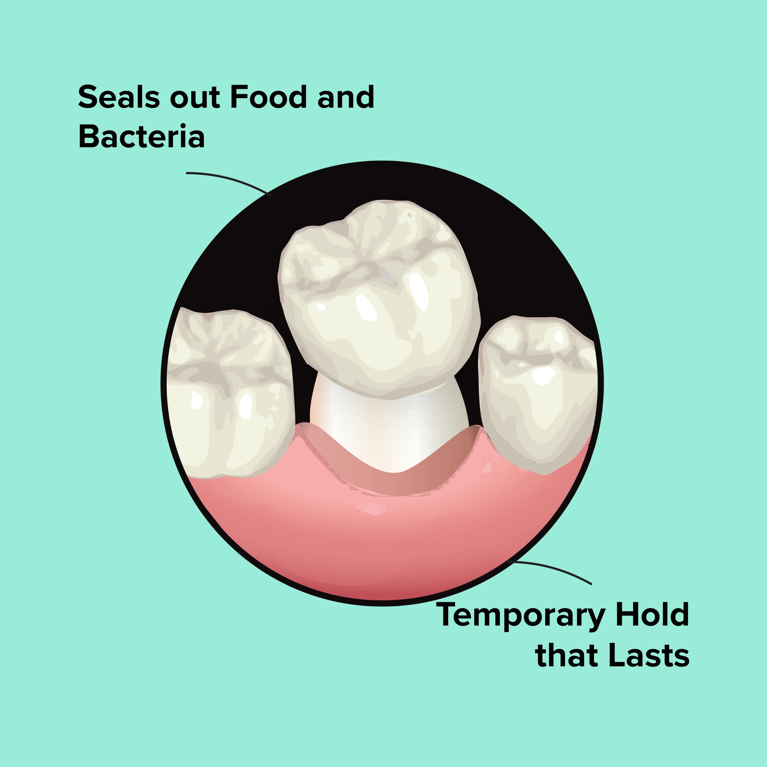 Dentemp Recap-It packaging shows three-dose pack option