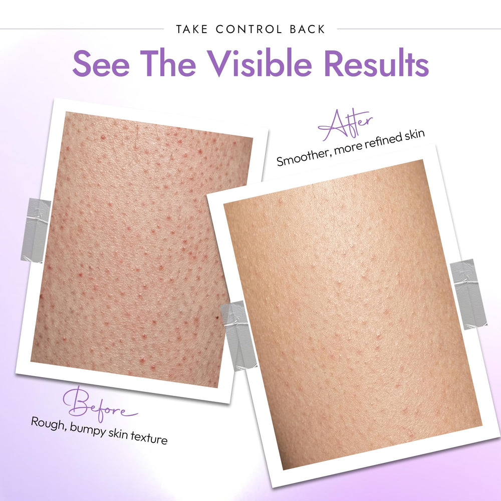 DERMAdoctor KP Bump Eraser foamy lather forming on skin during shower.