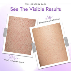 DERMAdoctor KP Bump Eraser foamy lather forming on skin during shower.