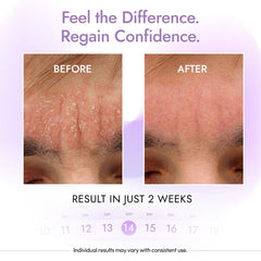 DERMAdoctor Seborrheic Dermatitis Shampoo applied to scalp in shower