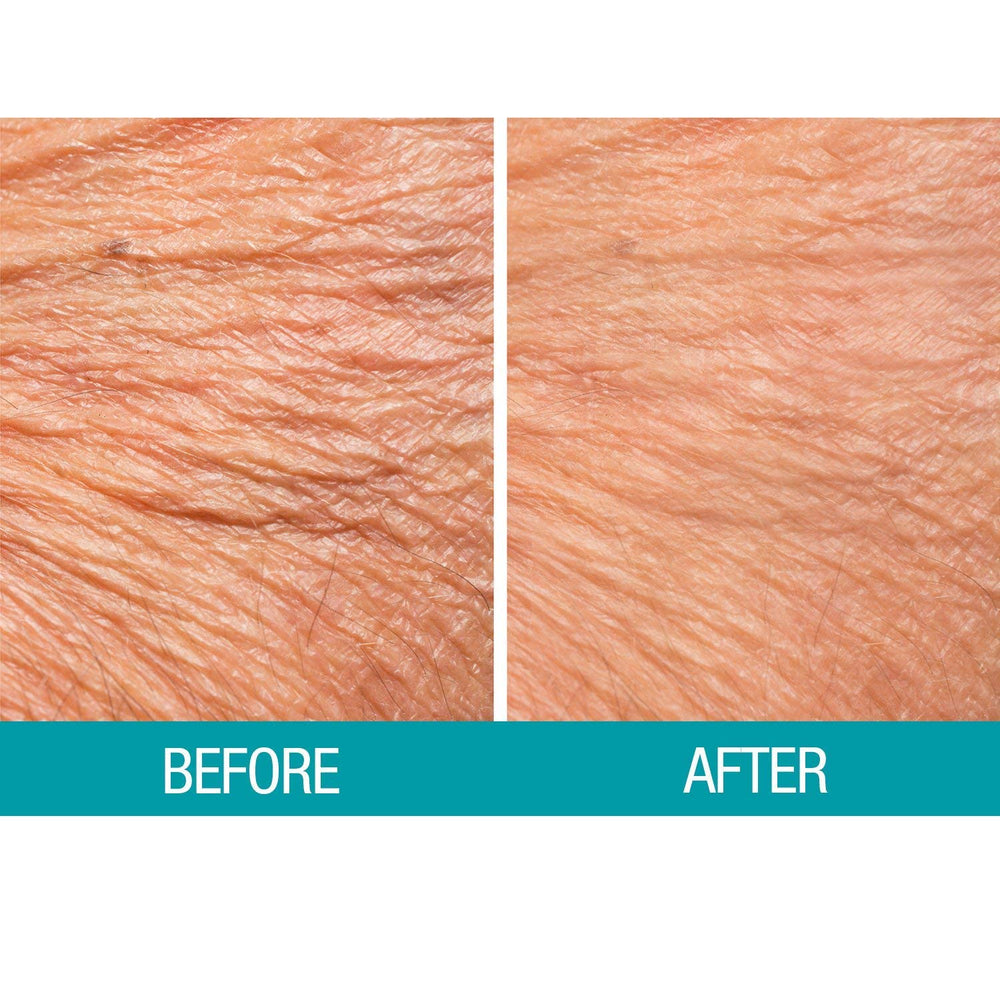 Dermactin Crepe Be Gone Body Souffle daily use for lasting moisture.
